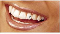 Dental Jwellery